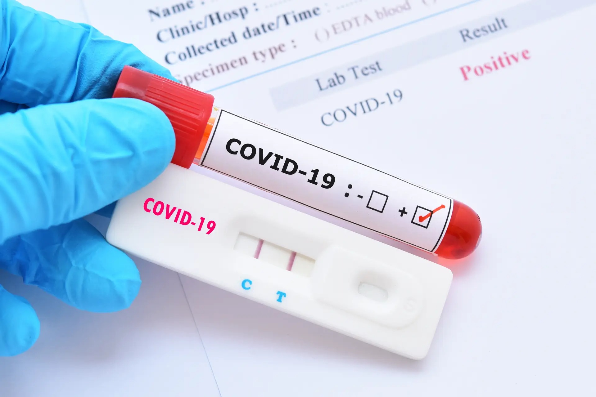 Teste COVID-19 pentru intrarea in Romania