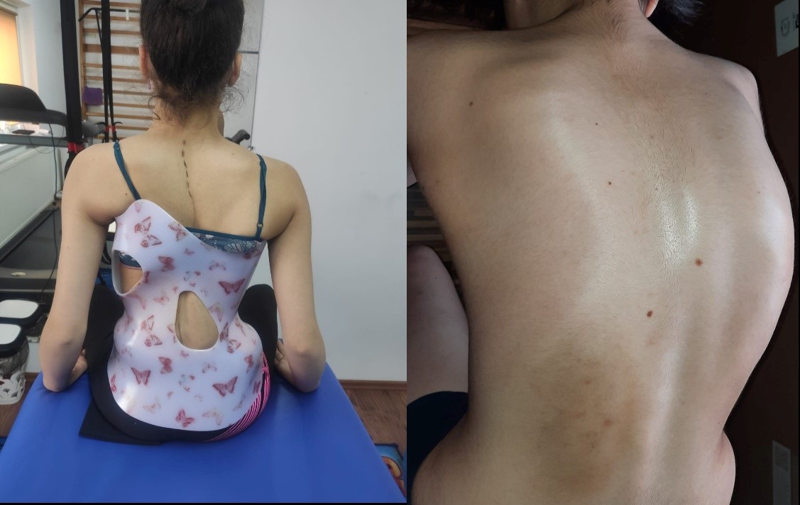 Adolescenta are nevoie urgentă de ajutor/ Foto: Facebook - Natalia Gianina Puica