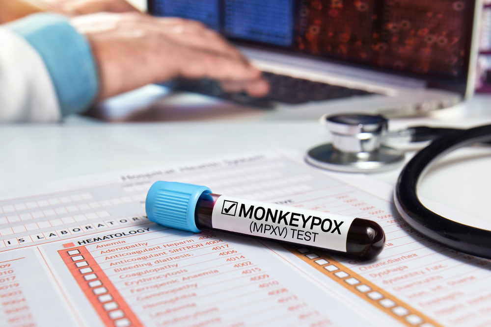 Este posibilă eliminarea epidemiei de variola maimuţei în Europa