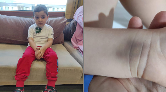 Matei nu a fost niciodată la grădiniță. Un simplu virus îi poate fi fatal/ FOTO: Asociația Salvează o Inimă