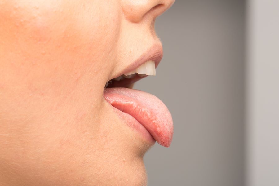Sursa foto: shutterstock