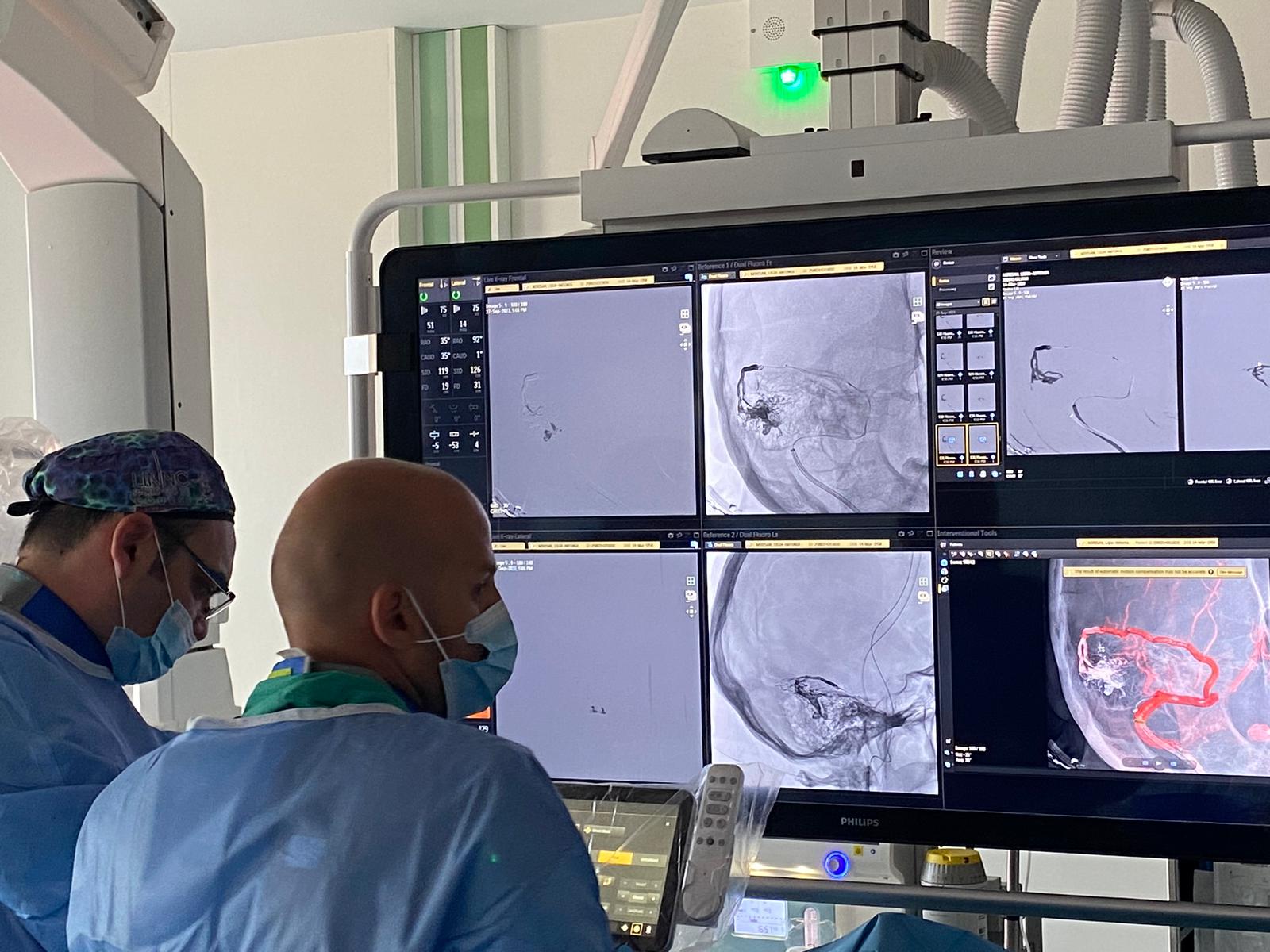 Primul tratament neuro-endovascular efectuat cu succes la Cluj-Napoca a fost efectuat în Spitalul Transilvania pentru tratamentul unei fistule durale arterio-venoase cerebrale