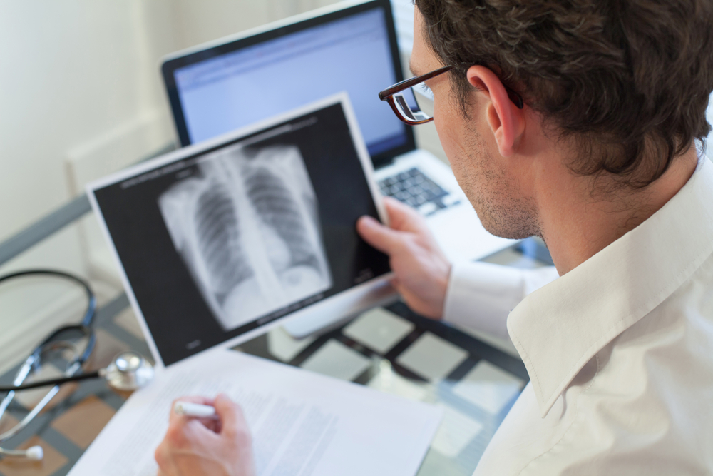 Peste 9.500 de cazuri de tuberculoză
