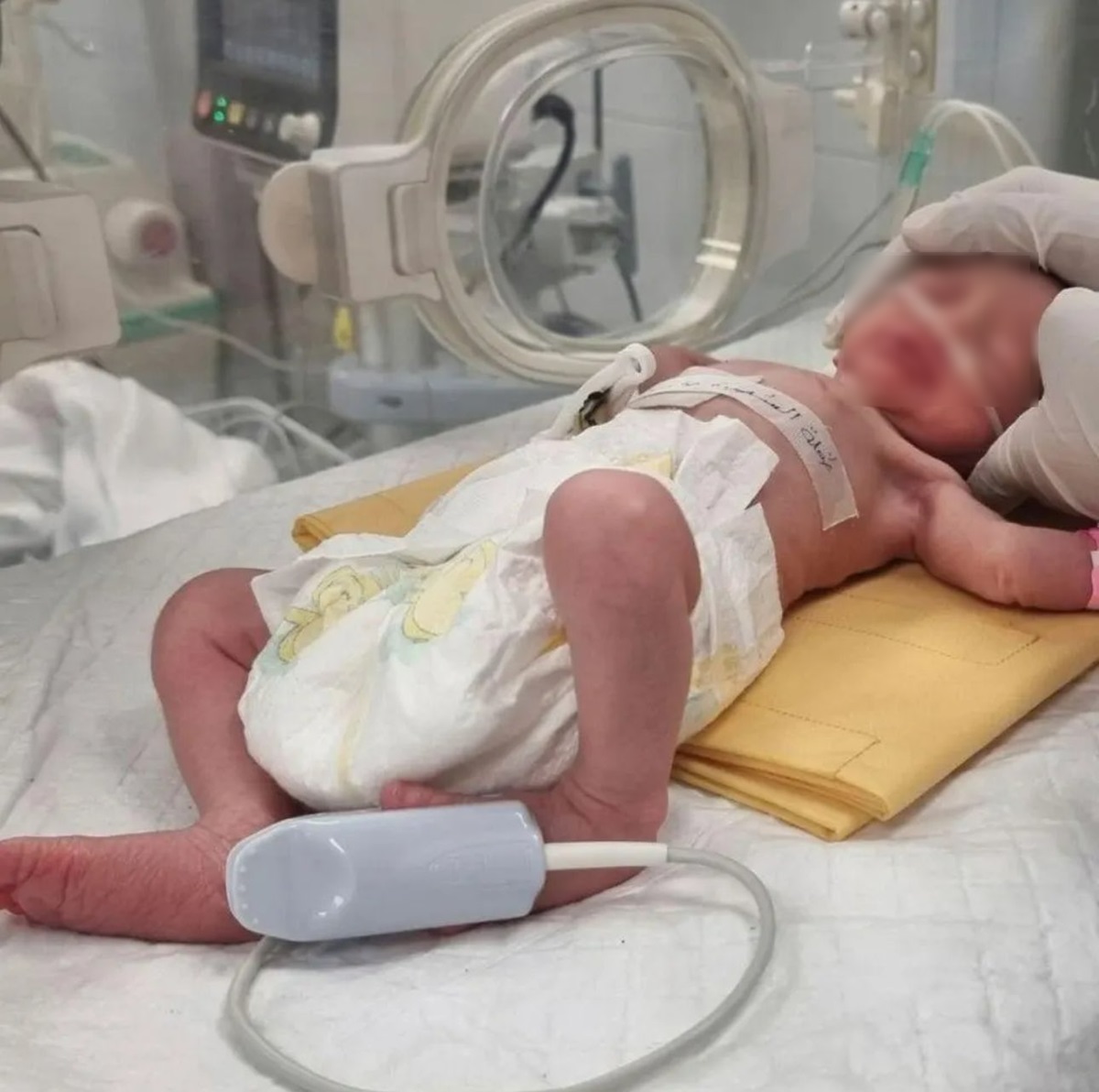 O fetiță a venit pe lume după ce mama ei a intrat în moarte cerebrală. Foto: X / Siyaa