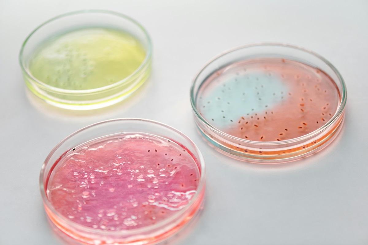 O femeie a aflat de ce nu poate slăbi. Bacteriile intestinale sunt cheia. Foto: pexels.com