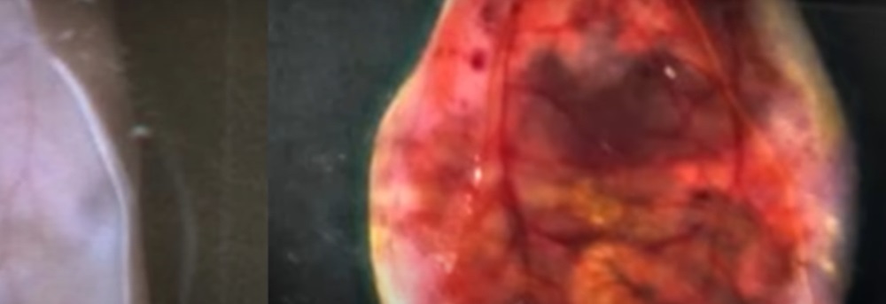 Un colorant alimentar obișnuit poate face pielea temporar transparentă