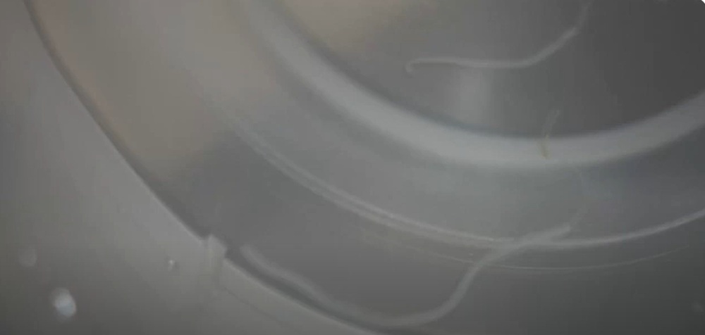 O femeie din China care se plângea de disconfort la ochi a fost diagnosticată cu patru viermi paraziți care îi creșteau sub pleoapa dreaptă. Foto cu caracter orientativ