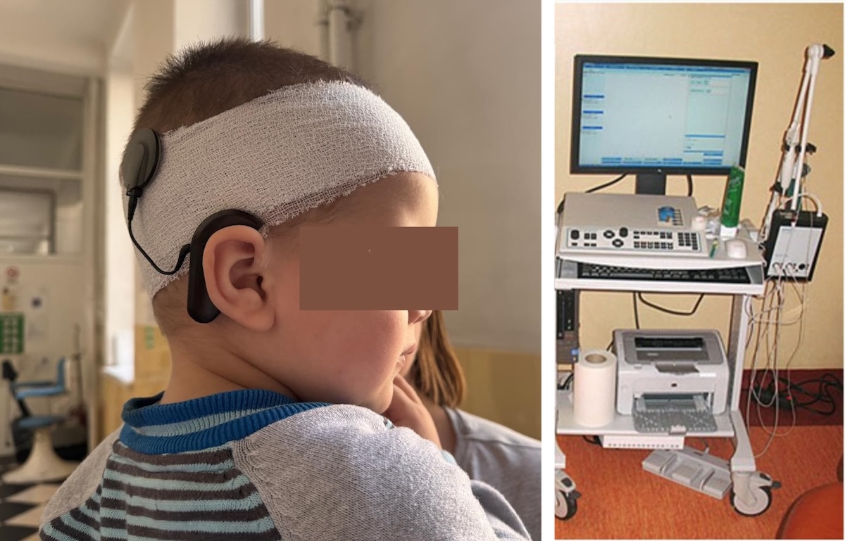 Problemele de auz