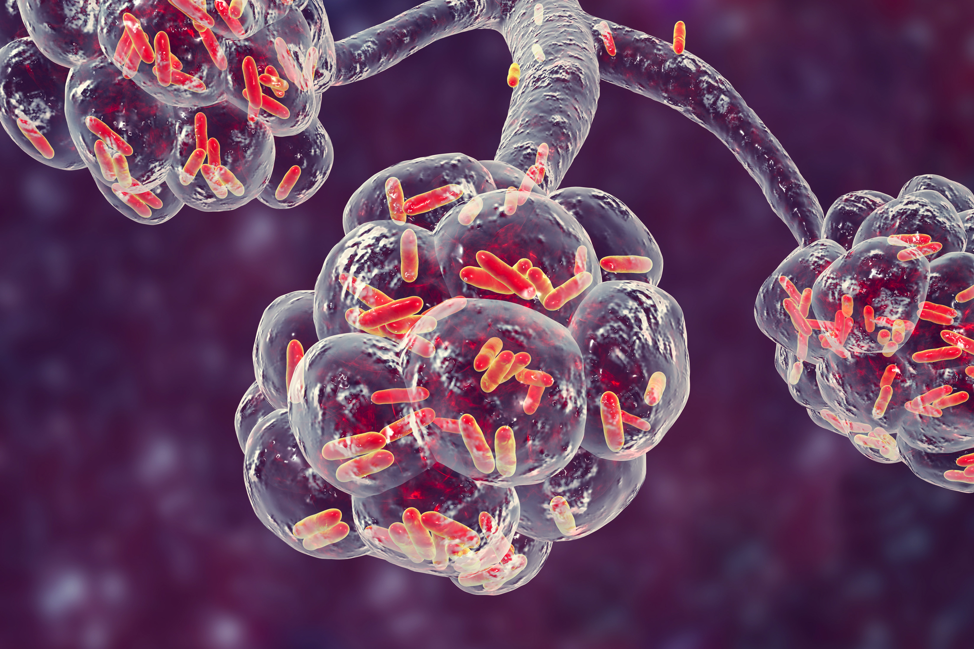 Klebsiella pneumoniae
