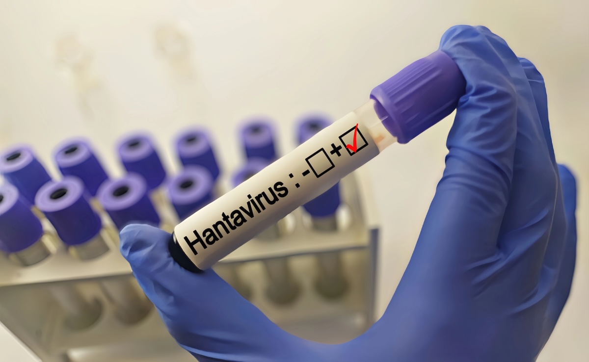În România au fost înregistrate 15 cazuri de Hantavirus în perioada 2023-2026 | Foto: DepositPhotos.com / Fotografie ilustrativă