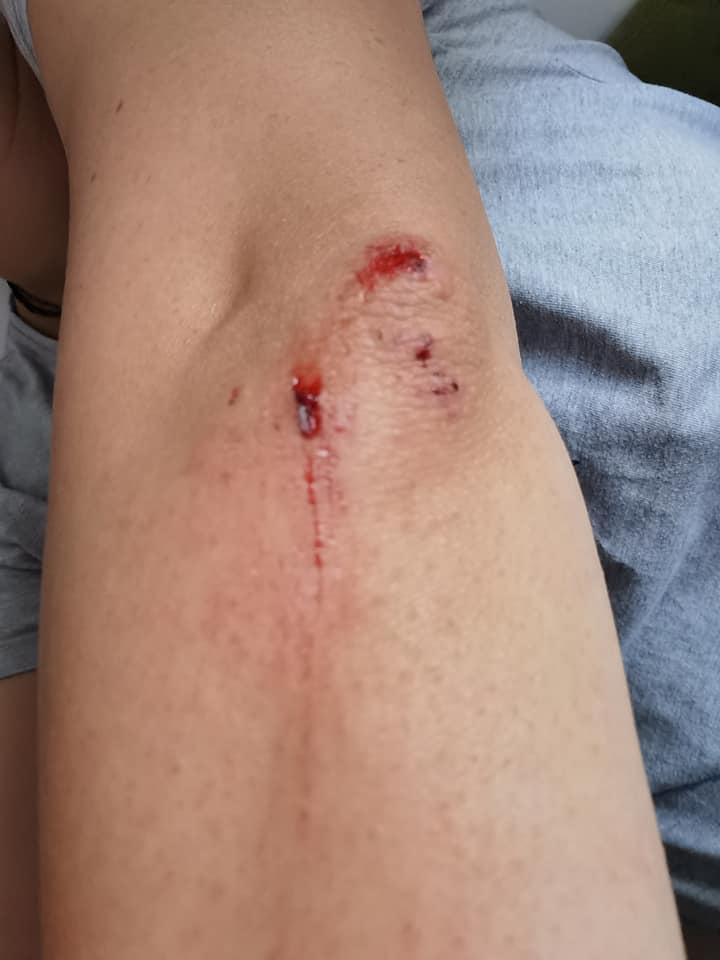 lovită de un livrator în timp ce se afla cu copilul pe scaun: „Era cu ochii în telefon”.