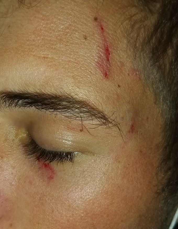 bătut romii din Cojocna în timp ce mergea la ore