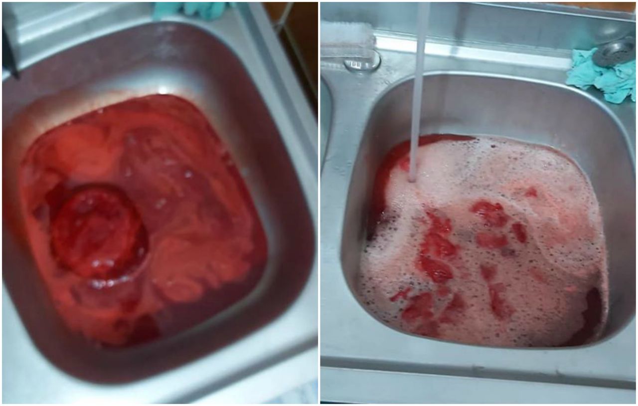 BOMBĂ BIOLOGICĂ! Mii de litri de sânge contaminat ajunge zilnic în sistemul de canalizare
