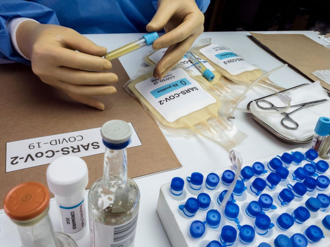 A apărut primul test care îţi spune 100% dacă ai avut coronavirus! Cum se numeşte şi unde îl găsim
