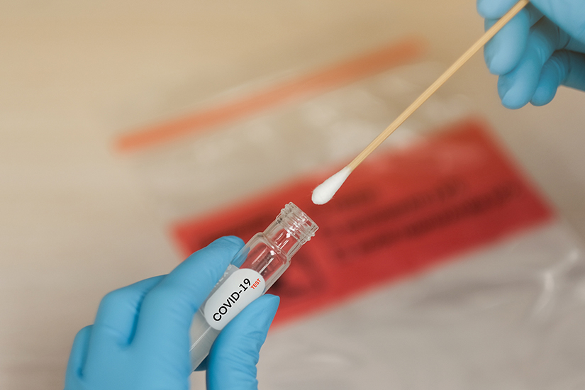 Cine se poate testa gratis de COVID19? Cine are prioritate la testare?